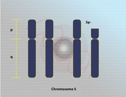 MeotrongYK 4